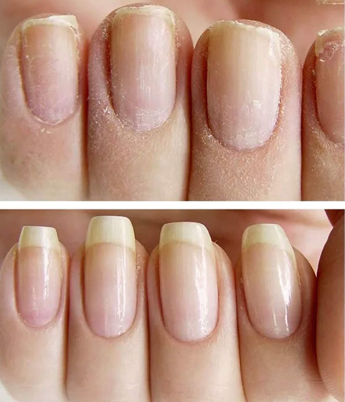 NAILVIVE Nail Serum Natural Keratin Nail Treatment Silk Proteins Proven Natural Formula Strengthening Hardening nails Instantly Prevents Splits Chips Peels Cracks on Your Nails