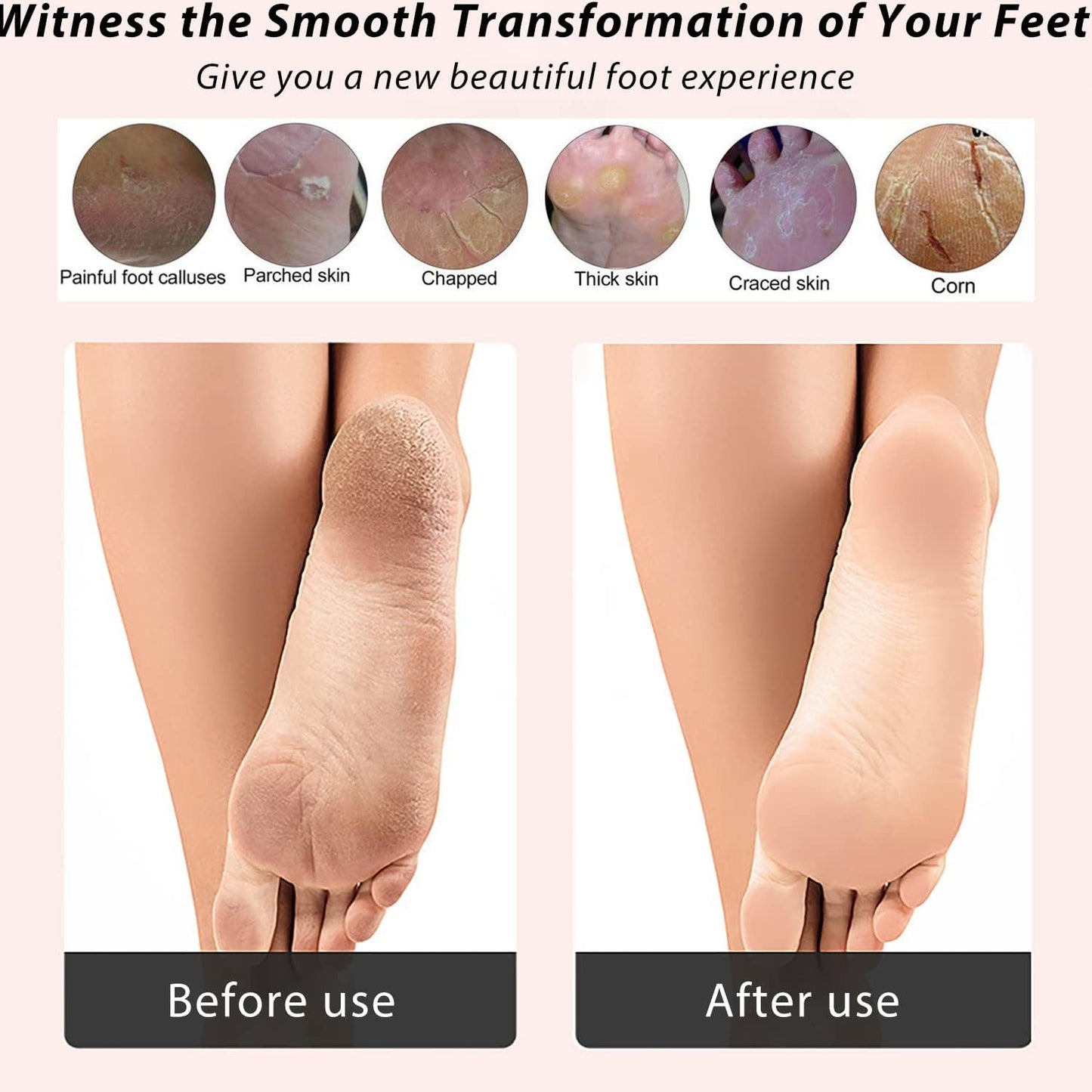 ICDI ICANdOIT Natural Bamboo Foot File Callus Remover-Multi Purpose 4 in 1 Feet Pedicure Kit with Foot Care Boar Bristle Brush,Pumice Stone,Foot Rasp,Sand Paper