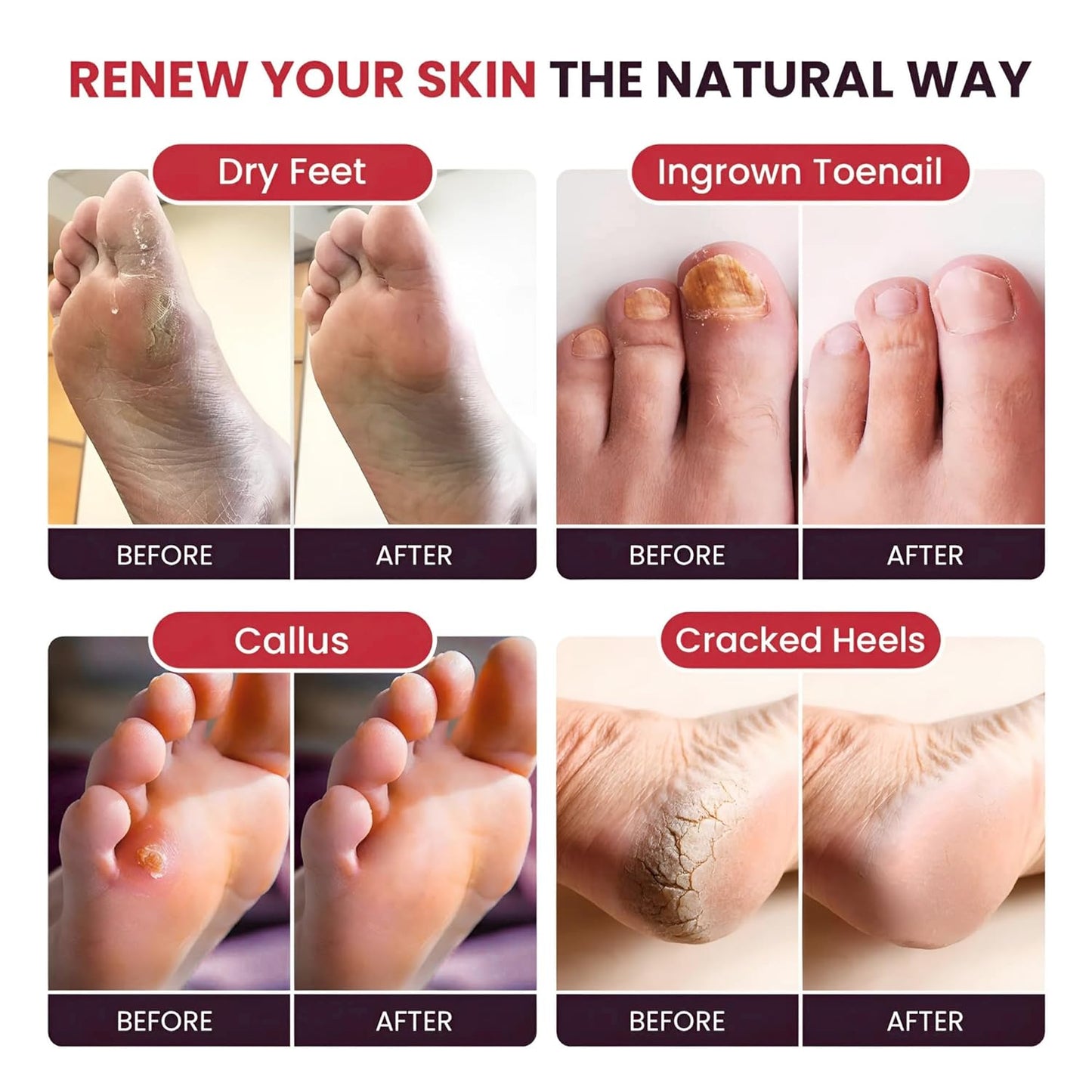 Foot Soak with Epsom Salts – All-Natural Blend for Relaxing Foot Care – Softens Calluses & Refreshes Feet – Invigorating Scent, Spa Pedicure, Made in USA – 16oz (Pack of 1)