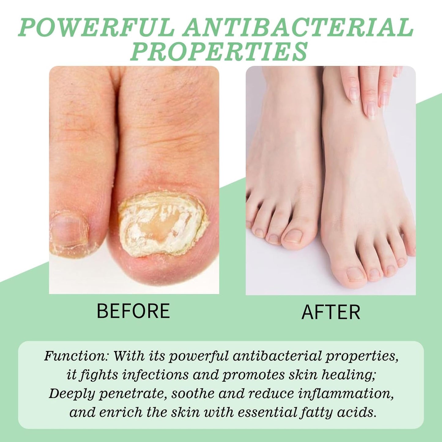 Nutraboost Nail Treatment, Nail Growth Serum for Repair & Strengthener,Multi-Purpose Nail Repair Oil Serum (1)